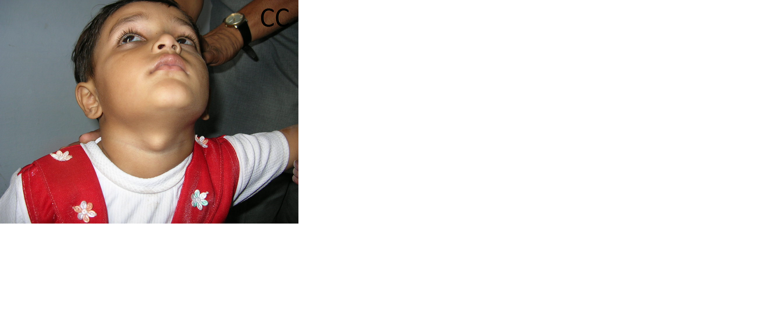 Pediatric General Surgery Image 10
